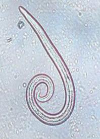 Longworm 1